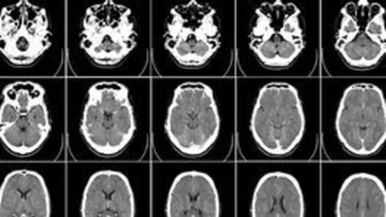 Bildgebende Diagnostik: Röntgen, CT, MRT und Sonographie